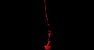 Understanding Hematuria: What Does It Mean to Urinate Chunks of Blood?