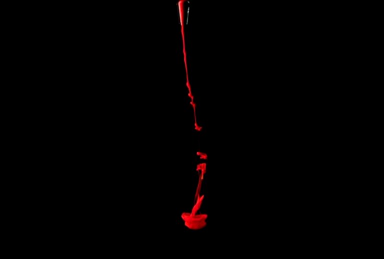 Understanding Hematuria: What Does It Mean to Urinate Chunks of Blood?