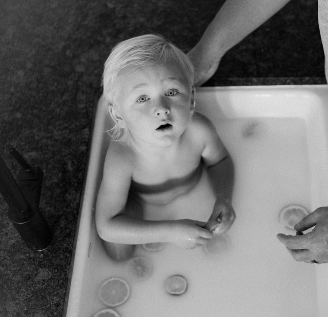 The Benefits of Using Bleach Baths for Eczema Relief